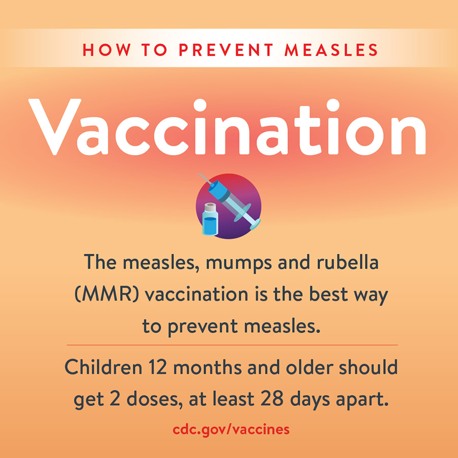 In South Carolina, measles is serious, so get vaccinated now